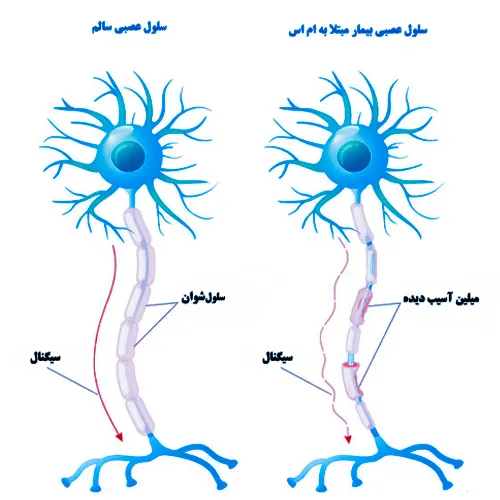 خارش پوست در نتیجه آسیب های عصبی